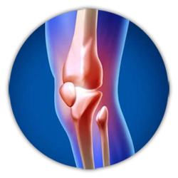 Best Joint Replacement Surgeon in Hyderabad