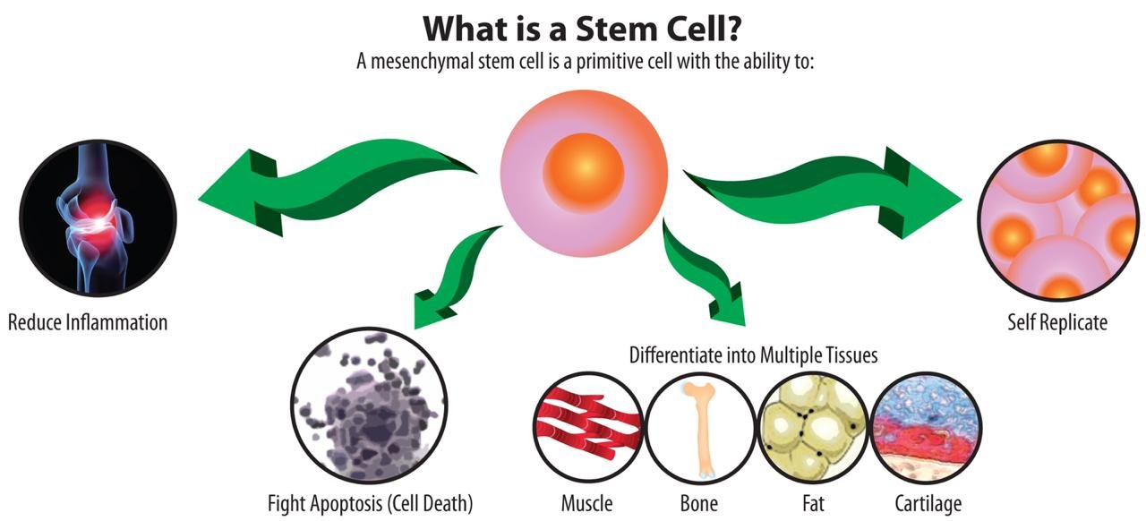 stem cell therapy for knee in hyderabad